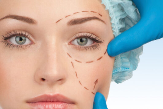 Eyelid Aesthetics