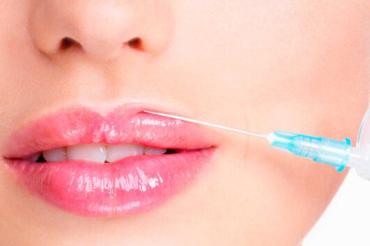 Lip Aesthetics