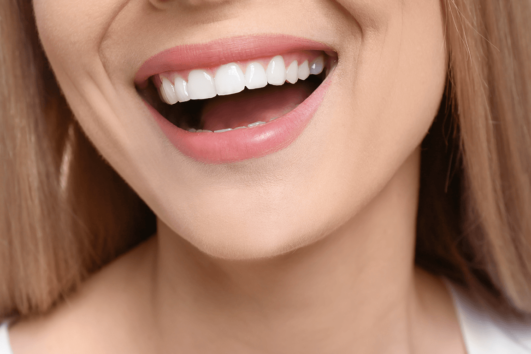 Hollywood Smile